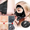 Kit Com 2 Máscara Preta Matto Verde Removedora De Cravos Skin Care